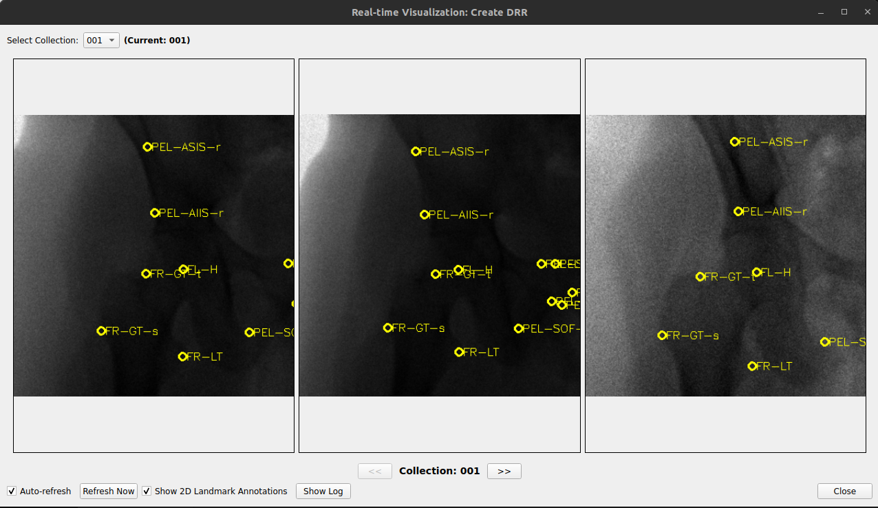 Create DRR real-time visualization window annotated